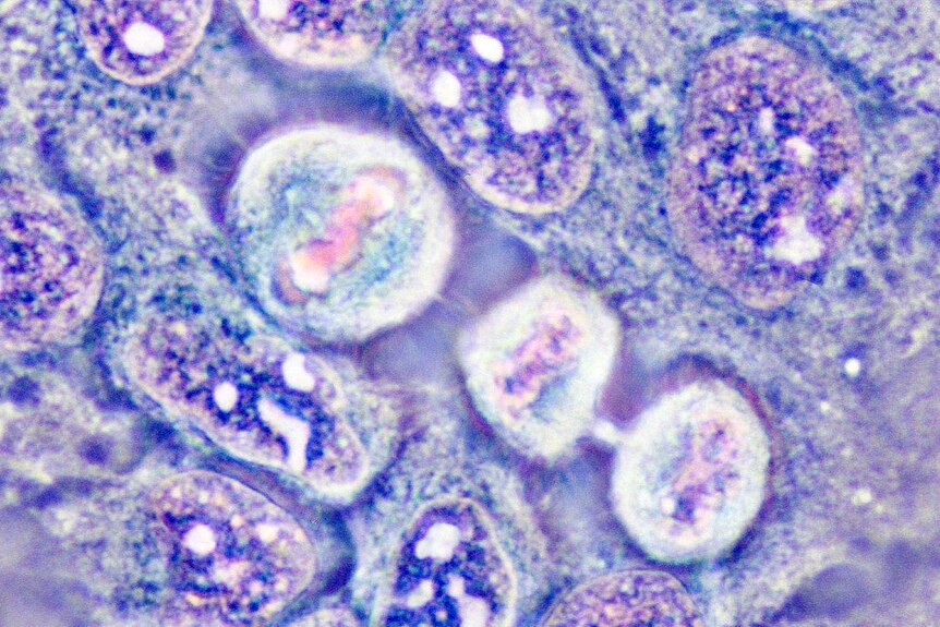 A slide that shows HeLa cells in different stages of cell division, coloured in purple and blue.