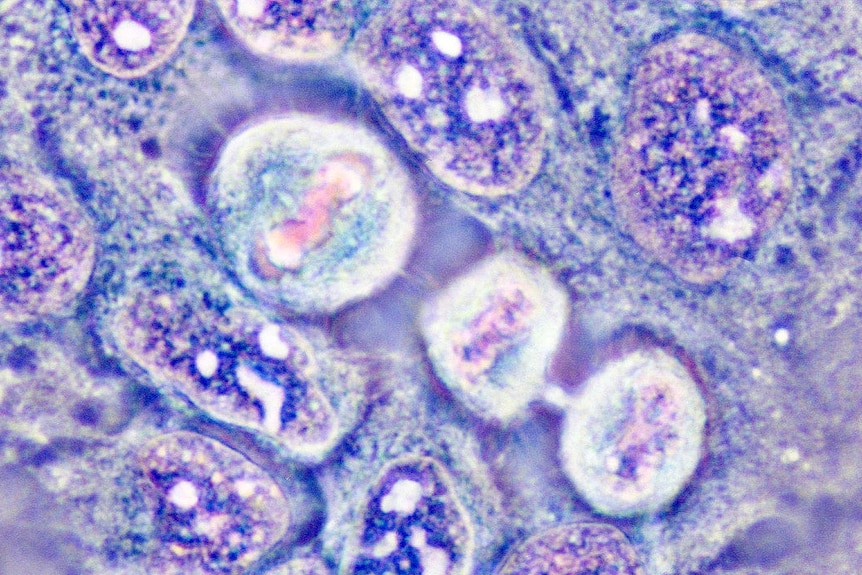 A slide that shows HeLa cells in different stages of cell division, coloured in purple and blue.