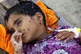 A child receives medical treatment at a local hospital in Pakistan's Muzaffargarh district.