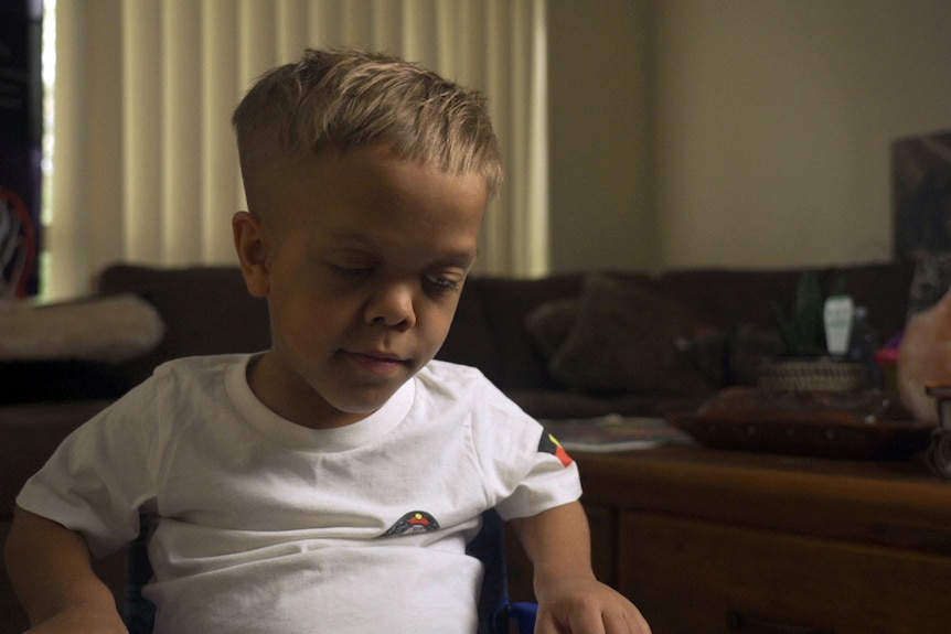 A young boy with a form of dwarfism called achondroplasia sits in a chair and looks down. His expression is neutral.