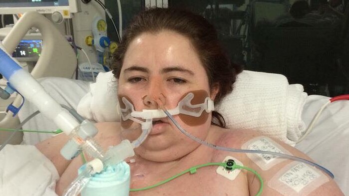 A woman in hospital with tubes coming out of face