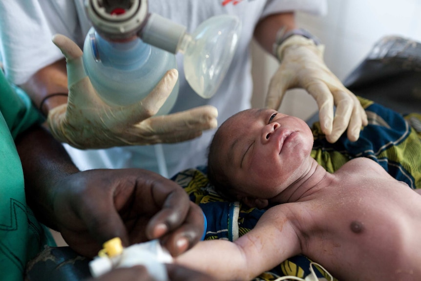 A baby gets help with its first breath.