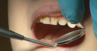 CUSTOM 340x180 Dentist teeth generic