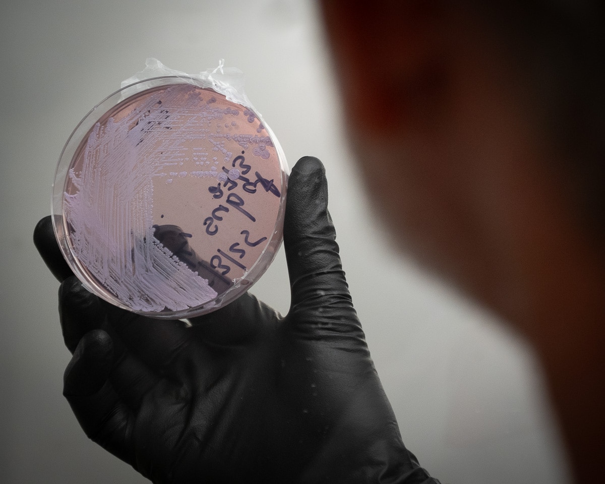 Una mano cubierta con un guante de goma negro sostiene una placa de Petri de color púrpura.