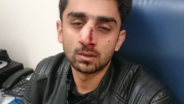 Abdullah Qaiser after the attack