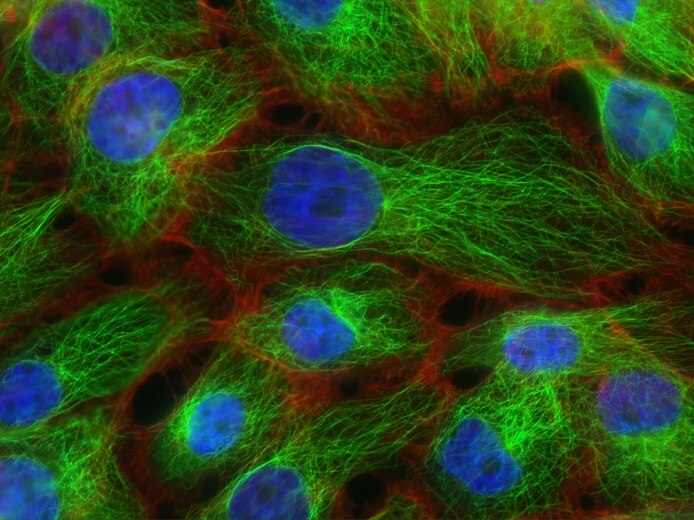Millions committed to the elusive search for dormant cancer cells - ABC ...
