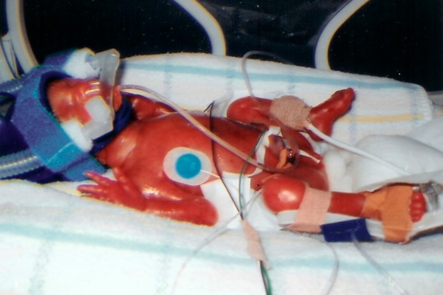 A premature baby in a hospital crib for a story on bringing a premature baby home. 