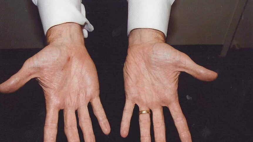 Gerard Baden-Clay's hands