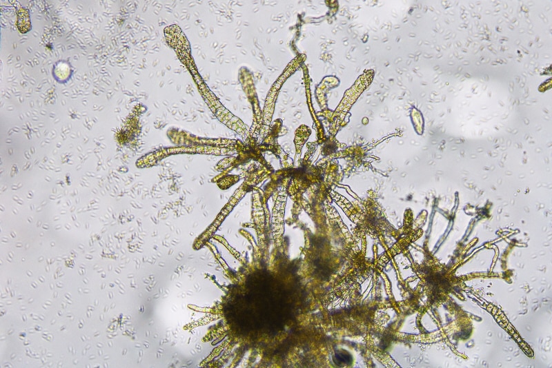 Star-like strands of green, multicellular algae can been seen at the end of a microscope against a grey background