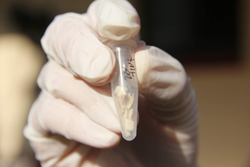 A close-up shot of a collection of sawtooth tissue in a small vial.