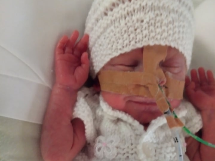 A premature baby with tubes in his nose gives a glimpse of a smile