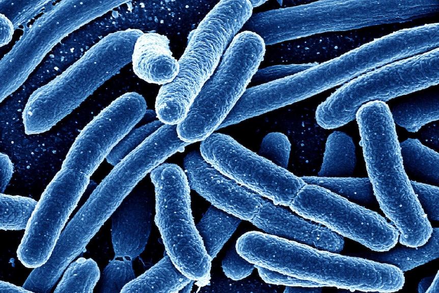 Coloured scanning electron microscope image of Escherichia coli bacteria