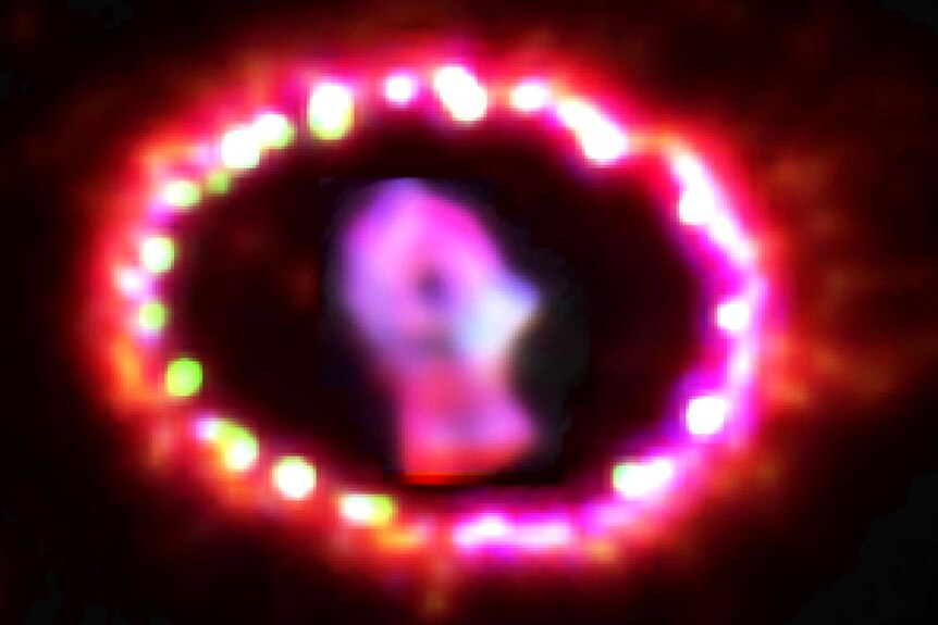 Supernova 1987A in its death throes.