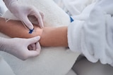 Doctor administers intravenous line into a patient's arm
