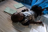 A toddler lays on a hospital bed with a blue mosquito net touching his toes. He gazes at the camera