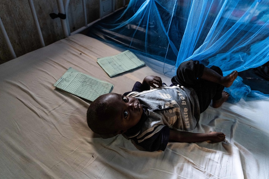 A toddler lays on a hospital bed with a blue mosquito net touching his toes. He gazes at the camera