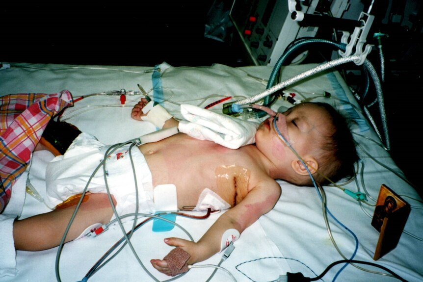 Ksenia as a baby, with tubes in her, with a big cut across her ribs.