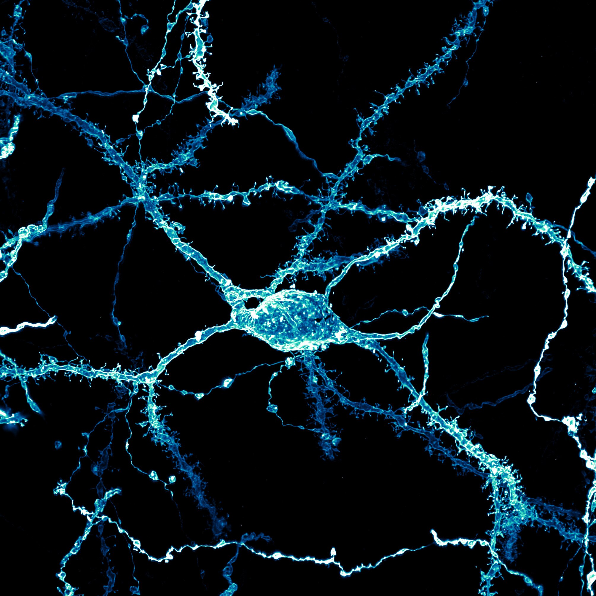 A blue neuron densely covered in dendritic spines from the striatum of an adult rat brain