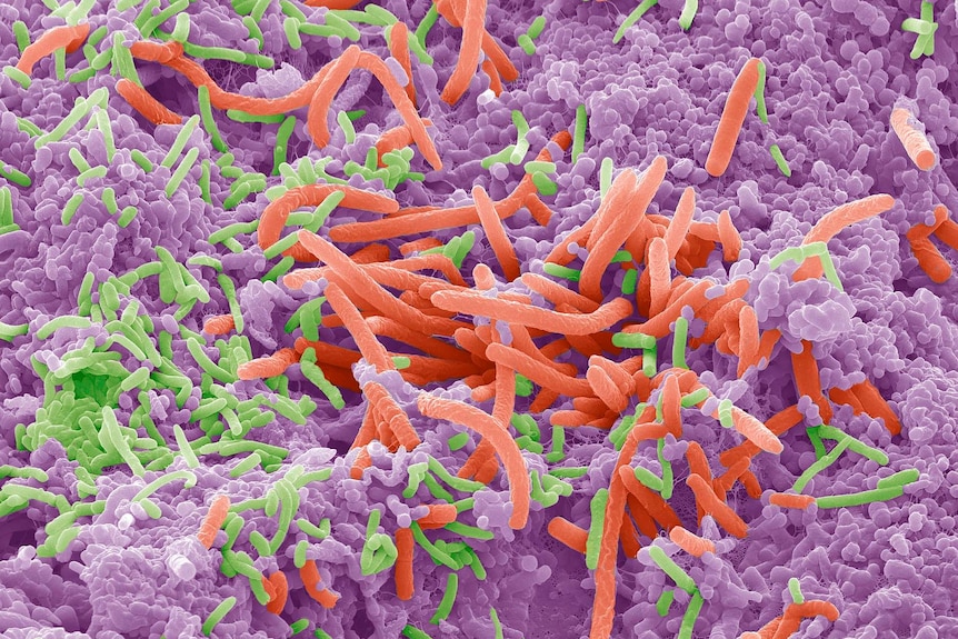 Coloured scanning electron micrograph of bacteria on the surface of a human tongue.