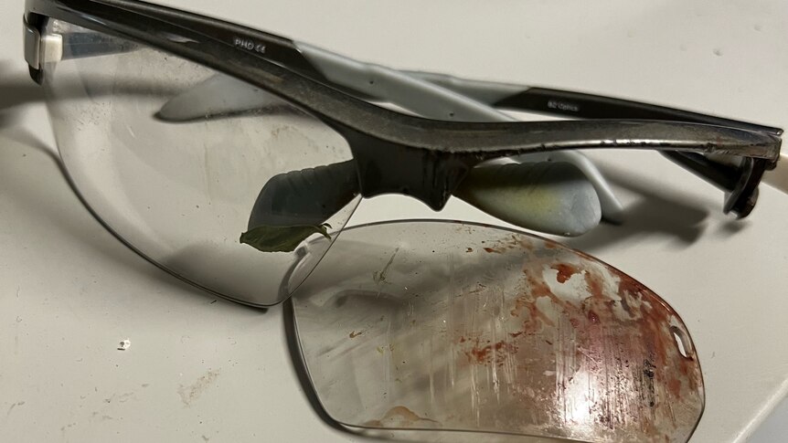 Damaged cycling glasses with old blood on them.