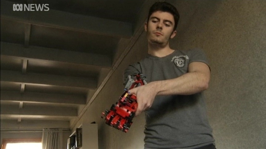 Youth builds prosthesis out of Lego