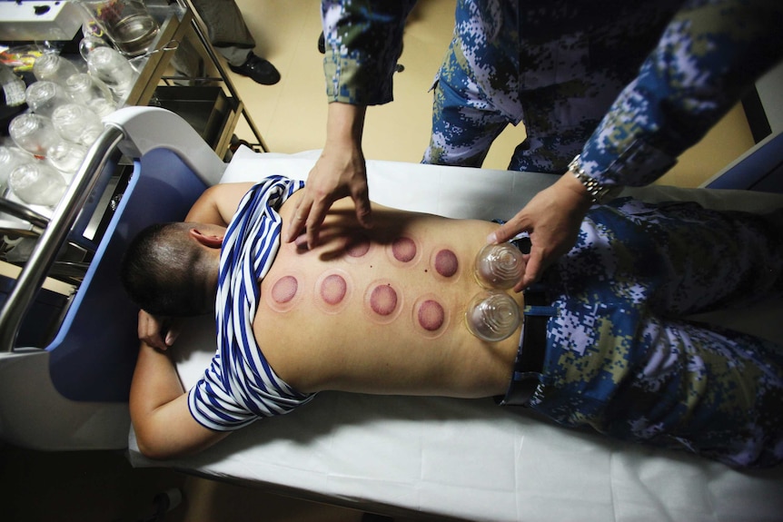 A man lying on a hospital bed receives cupping therapy. There are two cups on his back and several two rows of red circles.