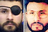 Two photos of the same man. In one, he's wearing an eye patch 