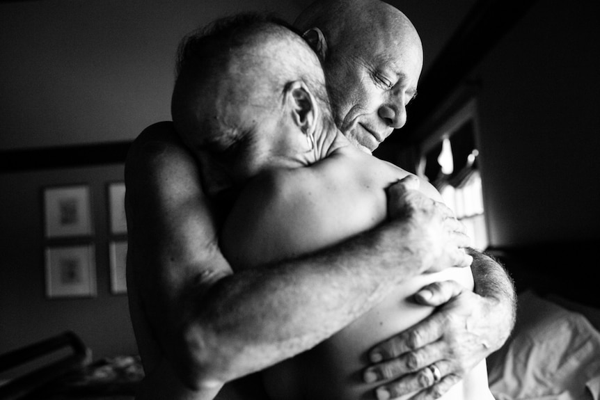 Laurel and Howie Borowick, both bald and shirtless, embrace.