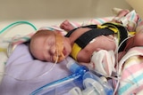 Baby Menasheh is connected to tubes as he lays in a cot