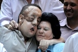 Rafael hugs his mother after undergoing a face transplant