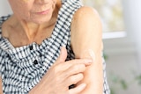 An older woman rubs a gel onto the skin of her upper arm.