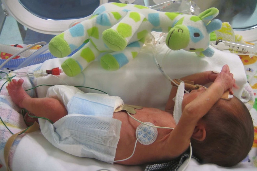 A premature baby next to a green and blue toy giraffe