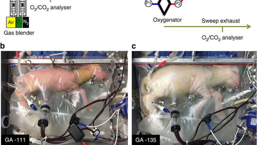 A lamb encases in an artificial womb, with drawing explaining the science