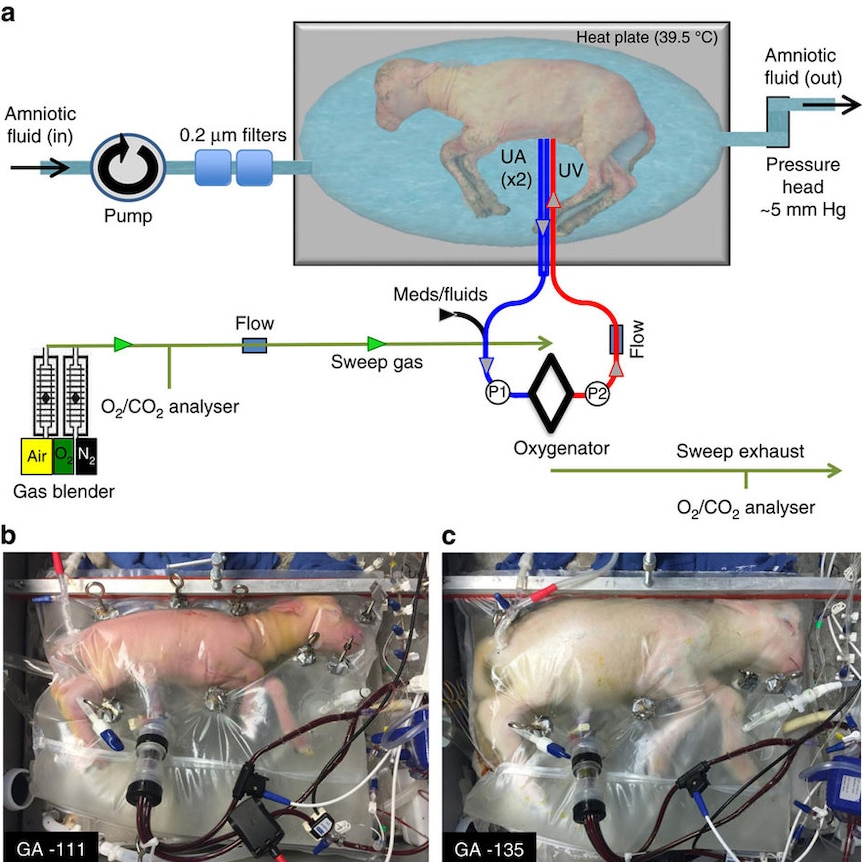 A lamb encases in an artificial womb, with drawing explaining the science