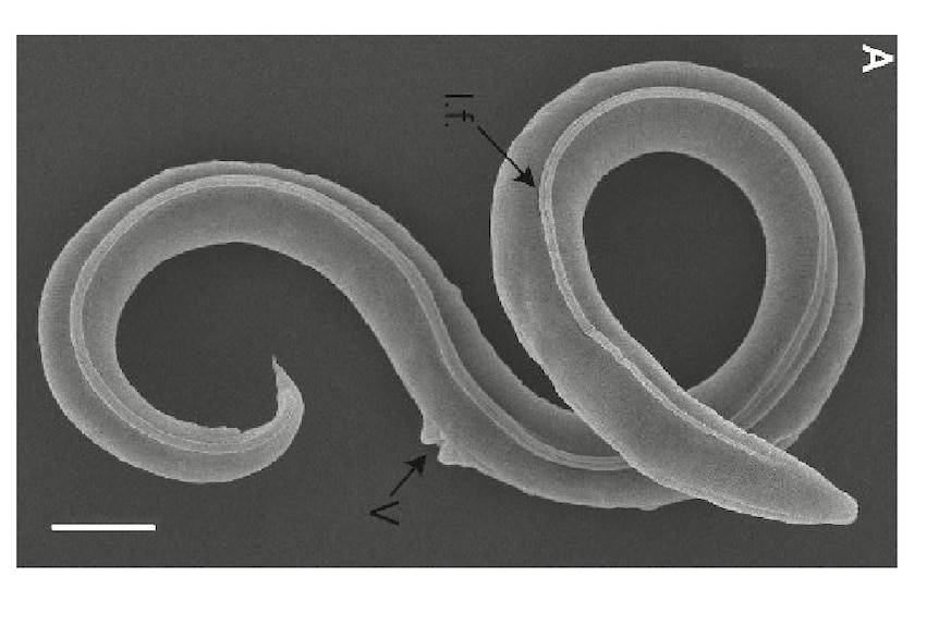 A grey photo taken from a report of the coiled worm 