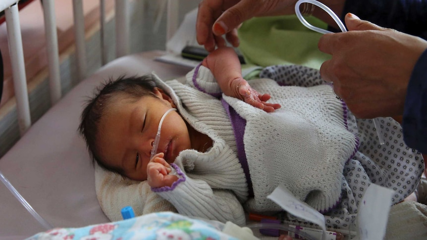 A newborn baby lays in a crib with tubes attached to it's nose.