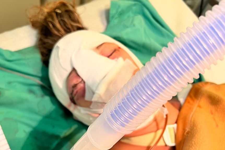 woman with bandaged face and tube in her mouth 