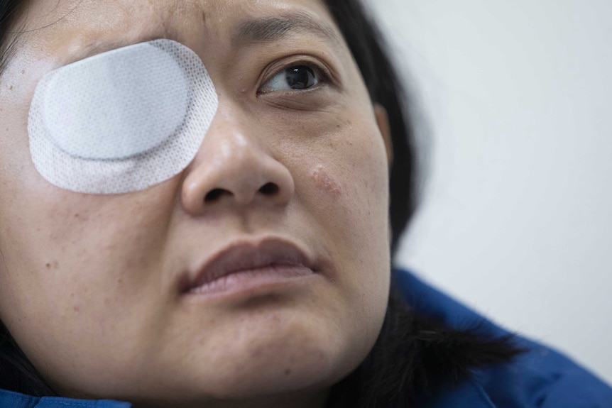 A close-up of a woman shows her frowning with a white bandage over one eye.