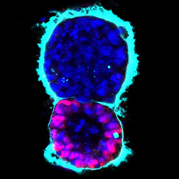 The artificial mouse 'embryo' at 72 hours.