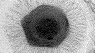 Electron microscopy of Megavirus (Lower) compared with Mimivirus (Upper).
