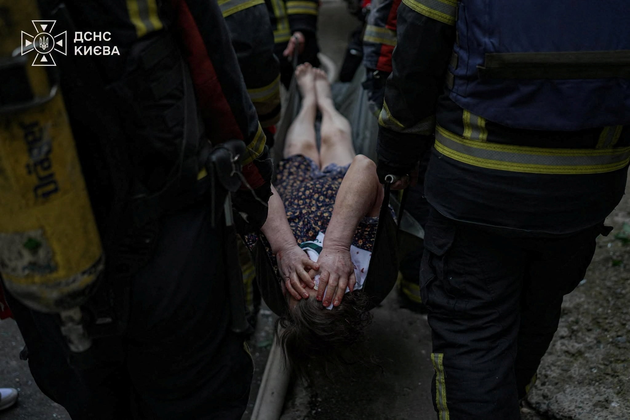 a woman in a gurney carried by firefighters with her hands over her face