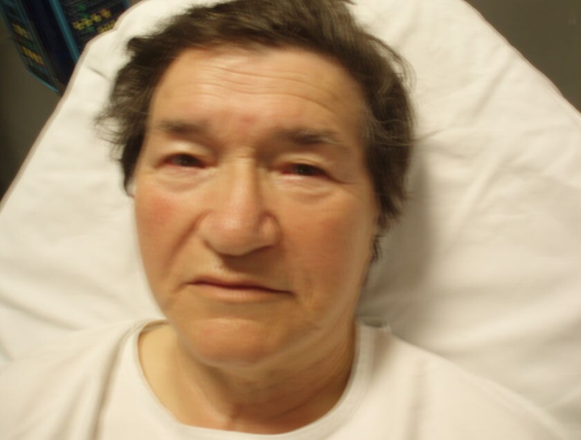 Elderly assault victim in critical condition - ABC News