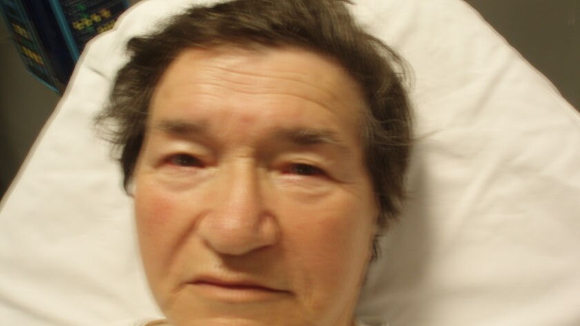 76-year-old Josephine Cesnik died from head injuries she suffered in the unprovoked attack.