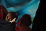 Two-year-old Somali refugee Shiniyo