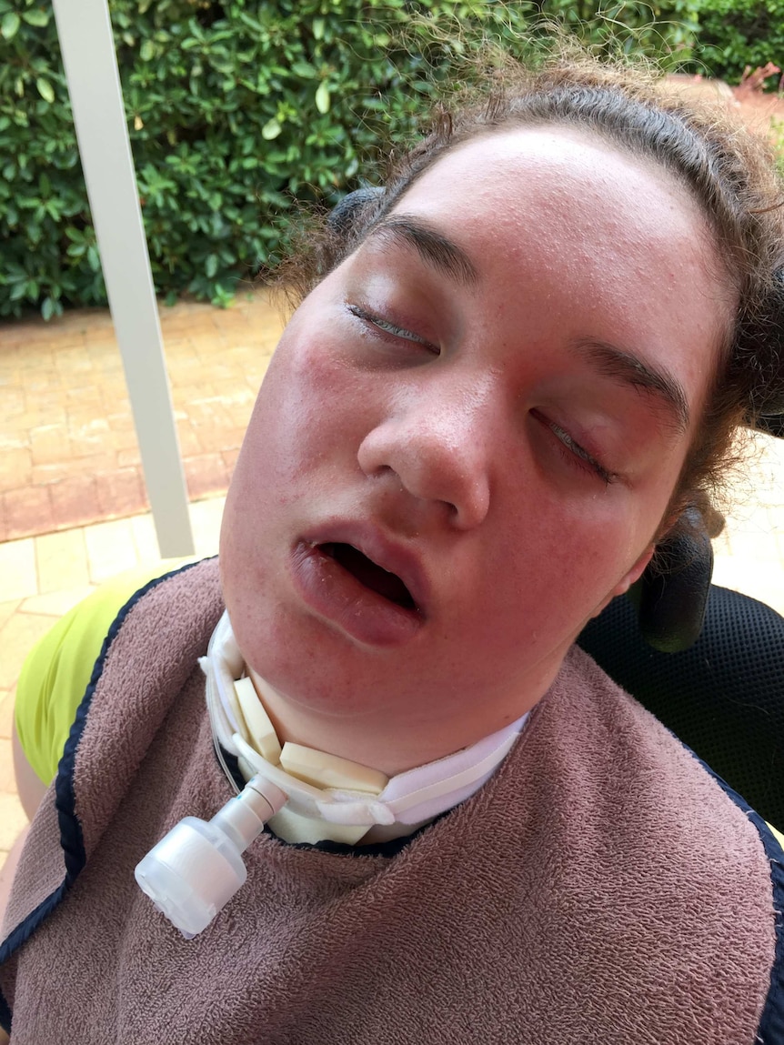 Ariana Pila breathing through a ventilator after she was struck by anti-NMDA receptor encephalitis.