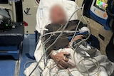 Image of an elderly man being treated after several days stranded in the remote WA bush.