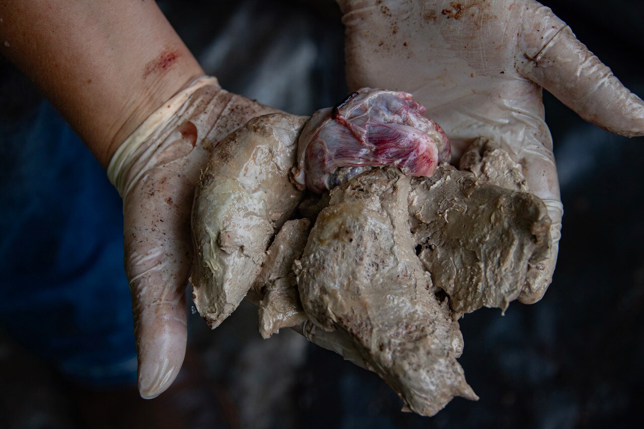 Las manos enguantadas sostienen la fibrosis