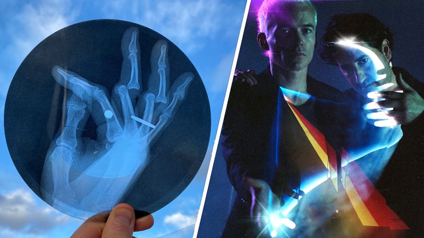 A collage of the x-ray vinyl showing Tony Hawk's finger injury and a press shot of The Avalanches