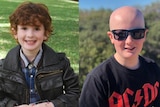 A side by side image of a young boy. On the left, he has a full head of hair. On the right, he is bald from alopecia.