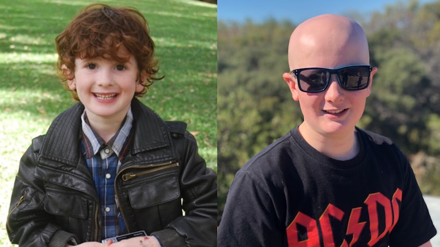 A side by side image of a young boy. On the left, he has a full head of hair. On the right, he is bald from alopecia.